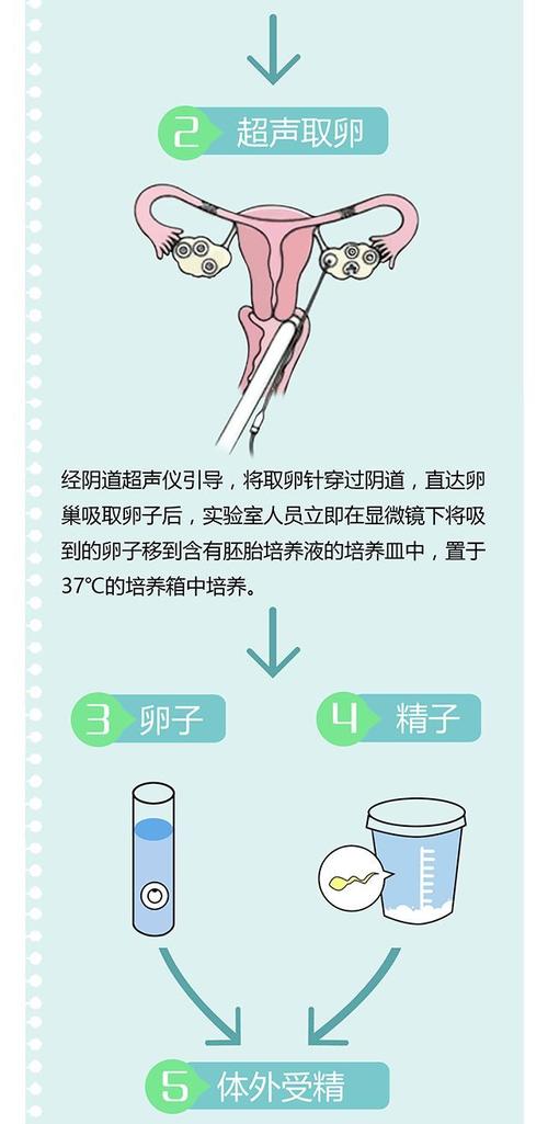 做供卵试管有哪些步骤_供卵试管步骤详解