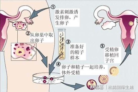 做供卵有年龄限制吗_供卵有年龄限制吗？详解供卵年龄限制及相关政策解读